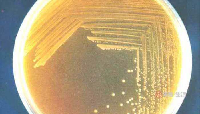 細菌菌落和真菌菌落的區(qū)別是什么 細菌菌落和真菌菌落怎么分辨(圖2) 細菌菌落和真菌菌落的區(qū)別是什么